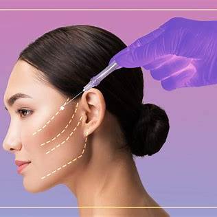 Thread Lift