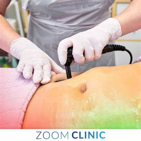 Liposuction